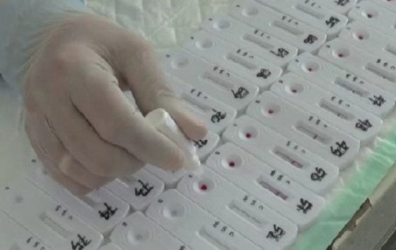 Kepala Dinas Tanaman Pangan Kabupaten Magetan positif COVID-19 jurnalsumatra,jatim,magetan